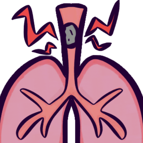 A closeup drawing of a simplified, cartoony pair of lungs, with a generic grey object lodged in the trachea. Spiky red lines emphasize the object